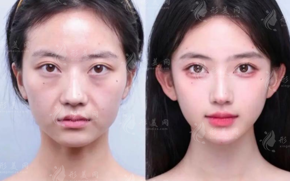 上海幼态脸医生排名2026，郭敬松申涛聂婕技术解析