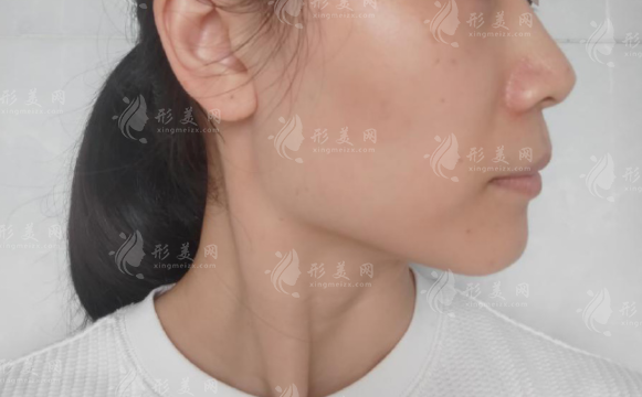 广州磨骨医院哪家好?广大、韩妃、紫馨资质与专家实力对比