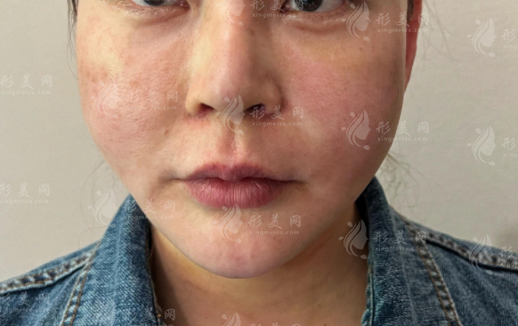 你是馒化脸还是幼态脸?5招自测+修复攻略一次说清 你是馒化脸还是幼态脸?5招自测+修复攻略一次说清