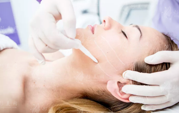 上海玻尿酸注射医生谁厉害?这10位微调大神让你悄悄变美