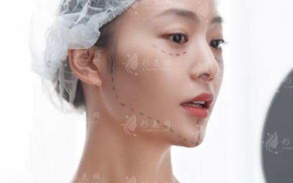 沈阳拉皮手术哪家强?这10家正规医院排名出炉!