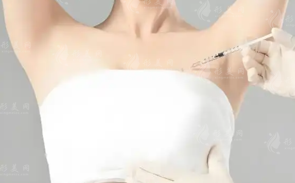 丰胸针多少钱一针?2026价格表+维持时间+避坑指南全解析