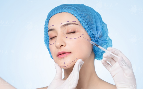 2026轮廓固定针价格揭秘!玻尿酸填充费用全解析 2026轮廓固定针价格揭秘!玻尿酸填充费用全解析