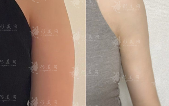 2026深圳吸脂医院哪家好?6家口碑机构实力盘点，附医生价格参考