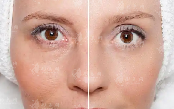 杭州面部抗衰医院哪家好?这6家技术审美好收费合理