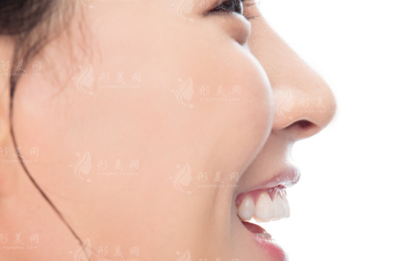 北京王晓健人中缩短术怎么样?20年经验+隐痕技术解析