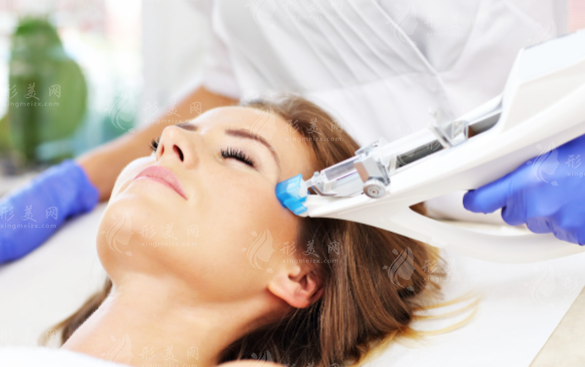 曼芙佳玻尿酸效果好吗?国产交联玻尿酸深度测评