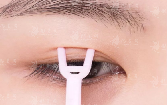 于晓雪做双眼皮靠谱吗?技术优势解析+价格全攻略