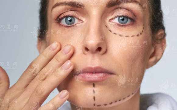 北京朝阳区整容医院哪家强?丽都/华韩/美莱/画美口碑爆棚