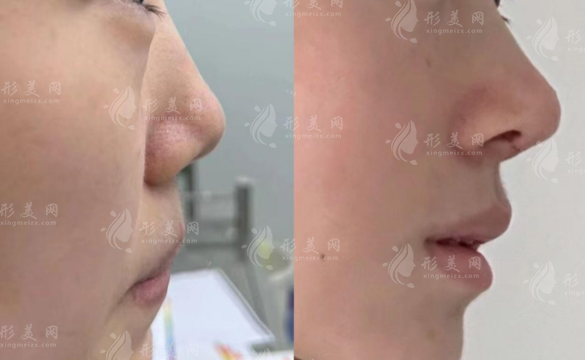 哈尔滨隆鼻医院哪家好?2026年十大口碑医院排行榜揭晓