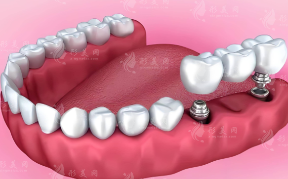 天津种植牙医院排名前十!2026口碑榜单揭晓