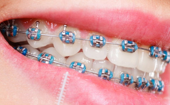 2026石家庄口腔医院排名前十!种植牙/矫正收费+口碑牙科推荐