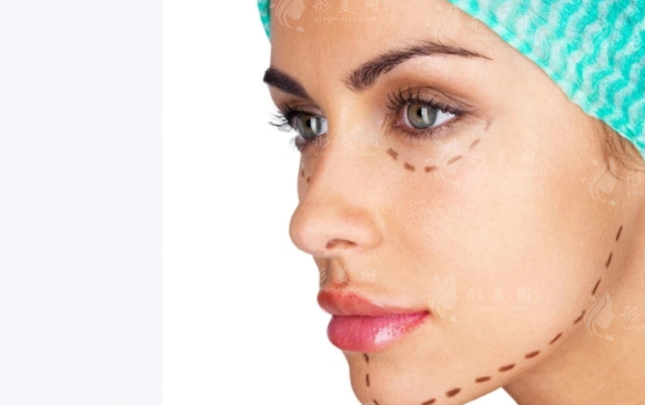 上海筋膜提拉医院哪家好?前十口碑排名+医生推荐