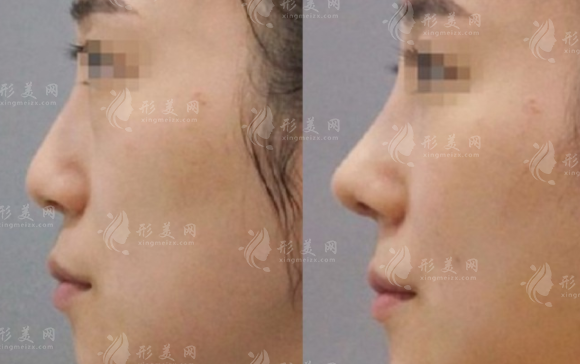 北京鼻修复医生哪家好?徐永成/韩兴斌/孙波等十大专家实力盘点