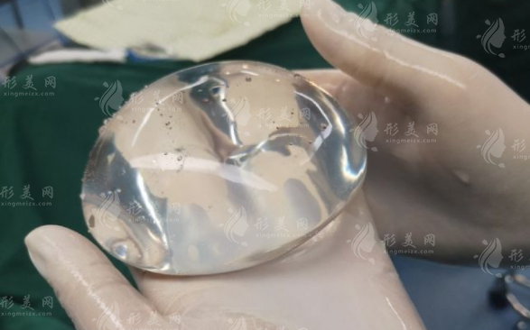 傲诺拉星熠假体型号全解析：选对不选贵，这份攻略请收好!