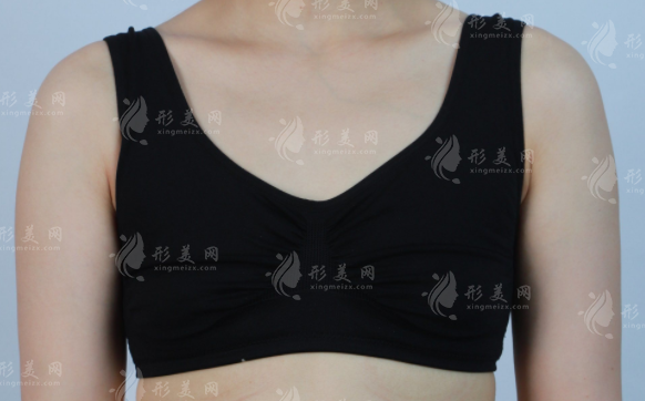 国内乳房再造医院排名前十出炉!附重建技术名医名单