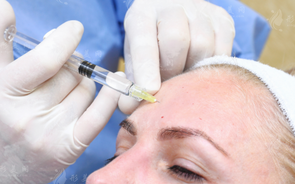 玻尿酸和胶原蛋白填充哪个好?维持时间与效果全方位对比!