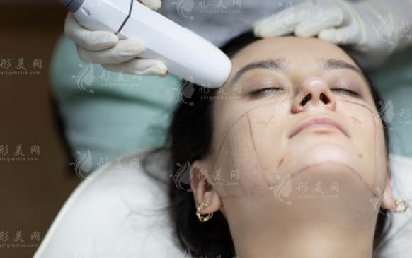 南京面部异物取出哪家好?5家正规医院排名榜整友力荐!