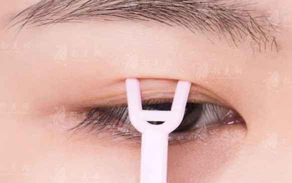 南京全切双眼皮哪家好?8家口碑医院+实力医生名单速收藏!