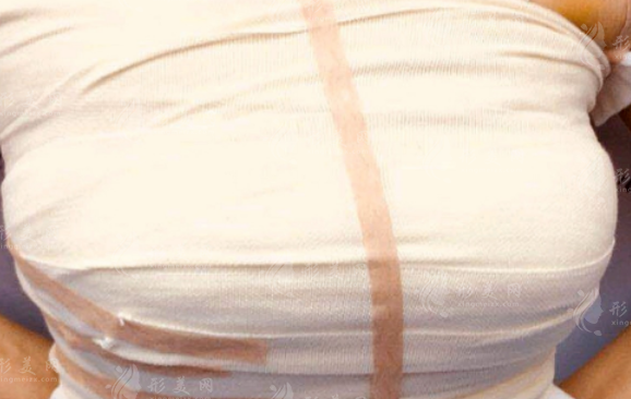 北京隆胸哪家医院好?排名前十医生实力强价格实惠