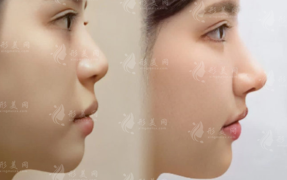 北京鼻修复医生排名前十：技术口碑好的正规医生推荐