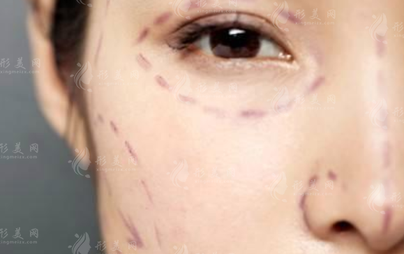 广州整形医院排名前三：曙光军美广大实力口碑全解析