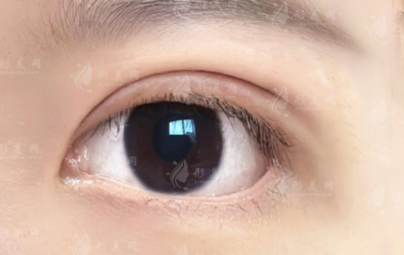 大连刘志刚眼修复口碑好吗?20年经验+失败修复价格全解析