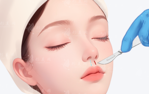 人中变平显老怎么办?口周抗衰正确思路别踩坑 人中变平显老怎么办?口周抗衰正确思路别踩坑