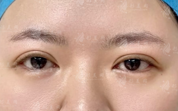 上海眼修复选罗文婷还是马娟?技术对比全解析