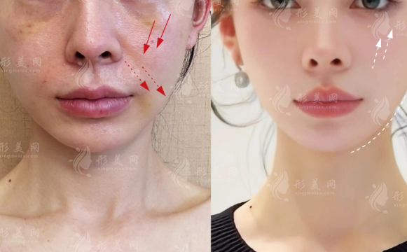 沈阳拉皮手术哪家强?杏林/名流/元辰/百嘉丽/北方整形口碑实测 沈阳拉皮手术哪家强?杏林/名流/元辰/百嘉丽/北方整形口碑实测
