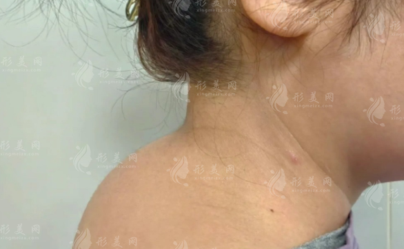 济南富贵包抽脂哪家好?5家靠谱医美机构实力盘点