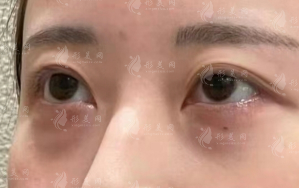 深圳眼修复医生排名前十:经验足/高难度修复/口碑好闭眼入