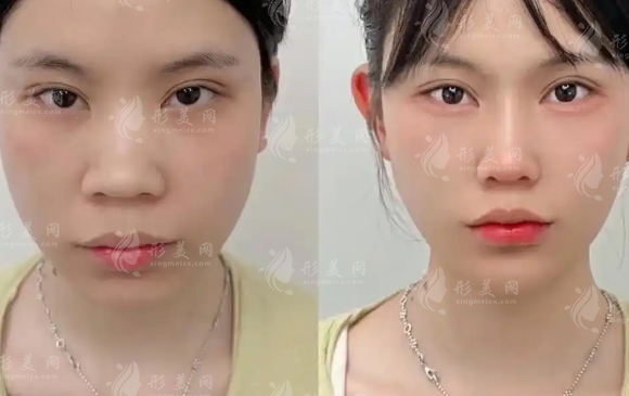 上海幼态脸打造医生排名:十位技术大咖名单及坐诊医院盘点 上海幼态脸打造医生排名:十位技术大咖名单及坐诊医院盘点
