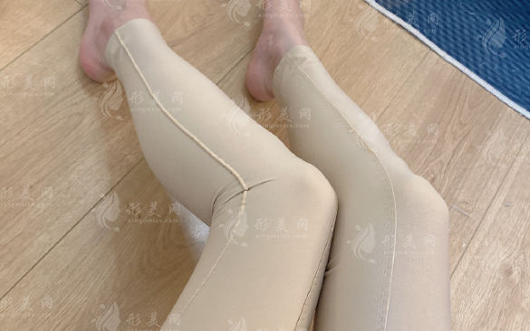 吸脂后皮肤会松弛吗?能瘦多少斤?真实恢复全过程