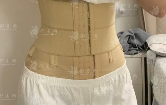 上海腰腹抽脂哪家医院好?华美、美莱、艺星技术实力盘点