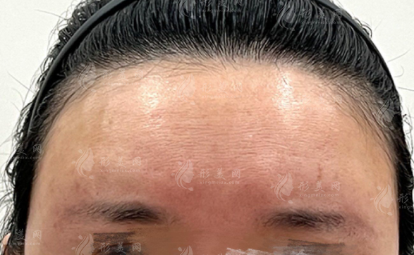 薛志强馒化修复价格表出炉!北京俊泰美好技术院长亲诊