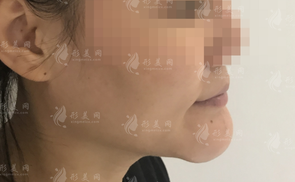 西安取生长因子选哪家?西京高一生米兰柏羽实测对比