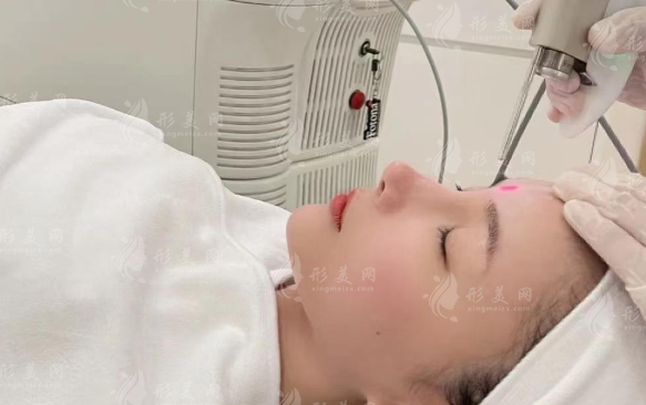 欧洲之星Fotona 4D和4D Pro区别?四模式与年龄肤质解析