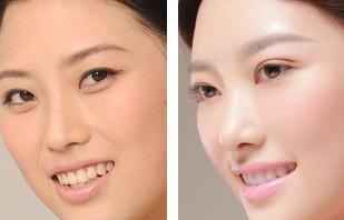 如何改善皮肤