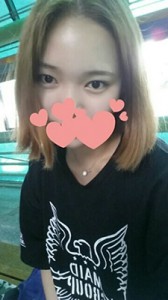双眼皮手术 魅力无限大 - 珍美网