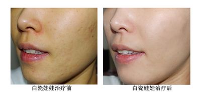陈锦安黑脸娃娃价格多少钱 - 珍美网