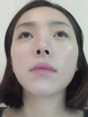 面部整形 逆袭成气质美女 - 珍美网