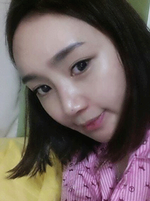 面部整形 逆袭成气质美女 - 珍美网