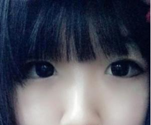 北京叶美人医疗美容诊所余森林医生割双眼皮案例:人都夸我美美了 - 珍美网