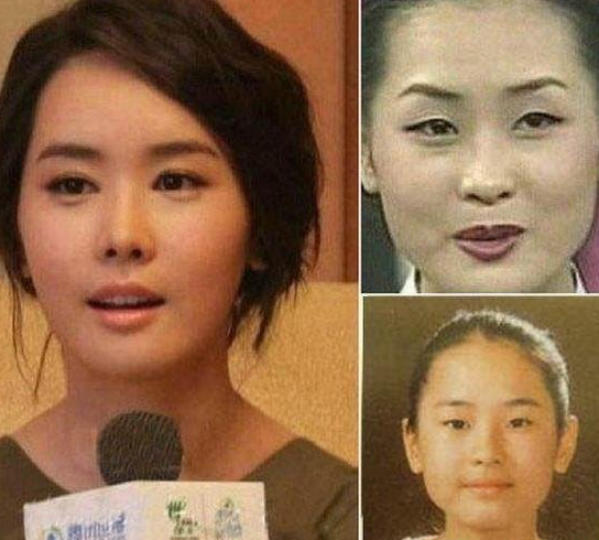 人造美女 趋势的潮流势不可挡 - 珍美网