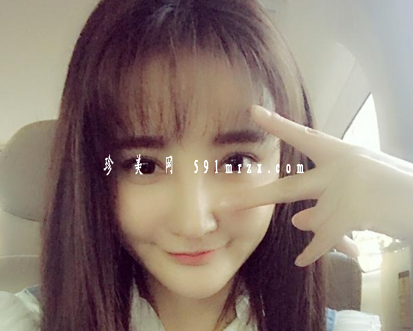 刘雨欣整形了吗 网友惊呼变脸认不出