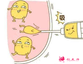 腰腹部吸脂减肥会干扰健康吗