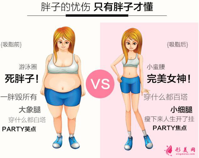 吸脂减肥的价格