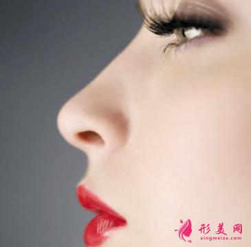 隆鼻后鼻子常常发红是什么问题