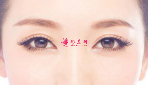 眼睛皮手术消肿有什么需要注意的地方